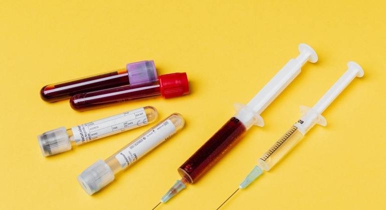 exame-de-sangue-coleta-de-sangue-24022022125949710