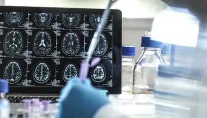 cerebro-laboratorio.jpg