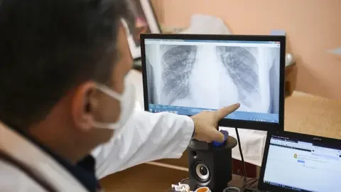 m%C3%A9dico-analisa-pulm%C3%A3o