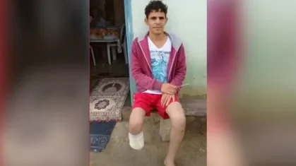 homem-amputa-o-proprio-pe.jpg